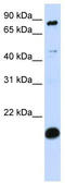 SP110 Nuclear Body Protein antibody, TA341442, Origene, Western Blot image 