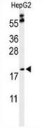 Peroxisomal membrane protein 2 antibody, AP53525PU-N, Origene, Western Blot image 
