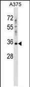 Pregnancy Specific Beta-1-Glycoprotein 2 antibody, PA5-71976, Invitrogen Antibodies, Western Blot image 