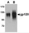 Envelope glycoprotein antibody, 4777, ProSci Inc, Western Blot image 