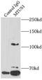 Microtubule-associated tumor suppressor 1 antibody, FNab05422, FineTest, Immunoprecipitation image 