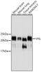 Von Hippel-Lindau Tumor Suppressor antibody, 14-179, ProSci, Western Blot image 