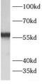 ATP Synthase F1 Subunit Beta antibody, FNab00733, FineTest, Western Blot image 