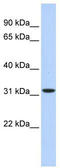 3-Hydroxyisobutyrate Dehydrogenase antibody, TA337872, Origene, Western Blot image 