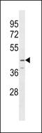 Serpin Family B Member 12 antibody, LS-C158948, Lifespan Biosciences, Western Blot image 