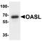 2'-5'-Oligoadenylate Synthetase Like antibody, A04123, Boster Biological Technology, Western Blot image 
