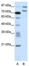 Zinc Finger Protein 709 antibody, TA341491, Origene, Western Blot image 