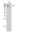 Fms Related Tyrosine Kinase 3 antibody, A00188-2, Boster Biological Technology, Western Blot image 
