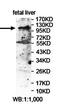 Leucine-rich repeats and immunoglobulin-like domains protein 2 antibody, orb78433, Biorbyt, Western Blot image 