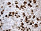 Pancreatic Lipase antibody, LS-C792899, Lifespan Biosciences, Immunohistochemistry paraffin image 