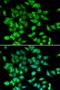Glycerol-3-Phosphate Acyltransferase, Mitochondrial antibody, orb247523, Biorbyt, Immunofluorescence image 