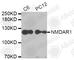 Glutamate Ionotropic Receptor NMDA Type Subunit 1 antibody, A7167, ABclonal Technology, Western Blot image 