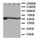 Aldehyde dehydrogenase, mitochondrial antibody, LS-C313509, Lifespan Biosciences, Western Blot image 