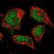 Chikungunya Virus antibody, NBP1-84527, Novus Biologicals, Immunofluorescence image 