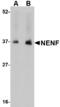 Neudesin antibody, A11147, Boster Biological Technology, Western Blot image 