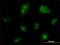 NCOA6 antibody, H00023054-M01, Novus Biologicals, Immunofluorescence image 