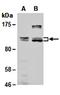 RB Binding Protein 8, Endonuclease antibody, orb66941, Biorbyt, Western Blot image 