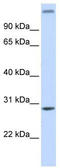 Alpha-ketoglutarate-dependent dioxygenase alkB homolog 2 antibody, TA339943, Origene, Western Blot image 