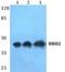 Histamine H2 receptor antibody, A05455, Boster Biological Technology, Western Blot image 