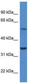 Cytochrome B5 Reductase 4 antibody, TA345051, Origene, Western Blot image 