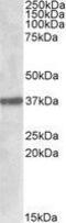 Sulfatase Modifying Factor 1 antibody, GTX88370, GeneTex, Western Blot image 