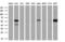 Cytoplasmic dynein 1 light intermediate chain 1 antibody, GTX84597, GeneTex, Western Blot image 
