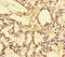 Exophilin 5 antibody, LS-C677860, Lifespan Biosciences, Immunohistochemistry paraffin image 
