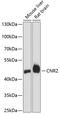 Cannabinoid Receptor 2 antibody, 18-009, ProSci, Western Blot image 