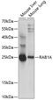 RAB1A, Member RAS Oncogene Family antibody, GTX66279, GeneTex, Western Blot image 