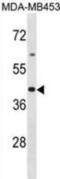 Olfactory Receptor Family 2 Subfamily B Member 6 antibody, abx031475, Abbexa, Western Blot image 