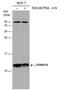 S100 Calcium Binding Protein A14 antibody, PA5-78543, Invitrogen Antibodies, Western Blot image 
