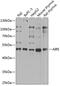 Autoimmune Regulator antibody, 15-413, ProSci, Western Blot image 