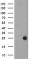 Ubiquitin Conjugating Enzyme E2 E3 antibody, TA504683S, Origene, Western Blot image 
