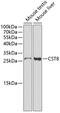 Cystatin-8 antibody, GTX53934, GeneTex, Western Blot image 