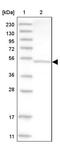 Aspartyl Aminopeptidase antibody, PA5-57638, Invitrogen Antibodies, Western Blot image 