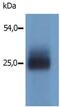 Linker for activation of T-cells family member 2 antibody, GTX54534, GeneTex, Western Blot image 