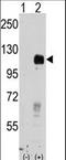 Ephrin type-B receptor 4 antibody, LS-C100287, Lifespan Biosciences, Western Blot image 