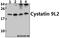 Putative cystatin-9-like 2 antibody, A19234-1, Boster Biological Technology, Western Blot image 