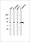 Gelsolin antibody, MBS9216178, MyBioSource, Western Blot image 