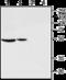 Gonadotropin Releasing Hormone Receptor antibody, GTX35245, GeneTex, Western Blot image 