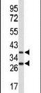 F-Box Protein 4 antibody, PA5-26303, Invitrogen Antibodies, Western Blot image 