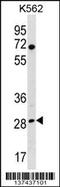 Replication protein A 30 kDa subunit antibody, 60-099, ProSci, Western Blot image 