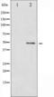 SMAD Family Member 3 antibody, TA325857, Origene, Western Blot image 