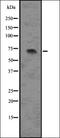 Low-density lipoprotein receptor-related protein 6 antibody, orb336581, Biorbyt, Western Blot image 