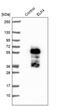 ETS Transcription Factor ELK4 antibody, PA5-55994, Invitrogen Antibodies, Western Blot image 