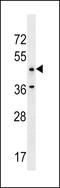 Ankyrin Repeat Domain 61 antibody, LS-C203720, Lifespan Biosciences, Western Blot image 