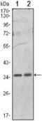 Protein Phosphatase 1 Catalytic Subunit Alpha antibody, GTX82774, GeneTex, Western Blot image 