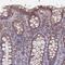 Lysine Rich Coiled-Coil 1 antibody, NBP1-92092, Novus Biologicals, Immunohistochemistry paraffin image 