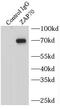 Zeta Chain Of T Cell Receptor Associated Protein Kinase 70 antibody, FNab09583, FineTest, Immunoprecipitation image 