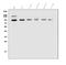 Transient Receptor Potential Cation Channel Subfamily V Member 2 antibody, A02786-3, Boster Biological Technology, Western Blot image 
